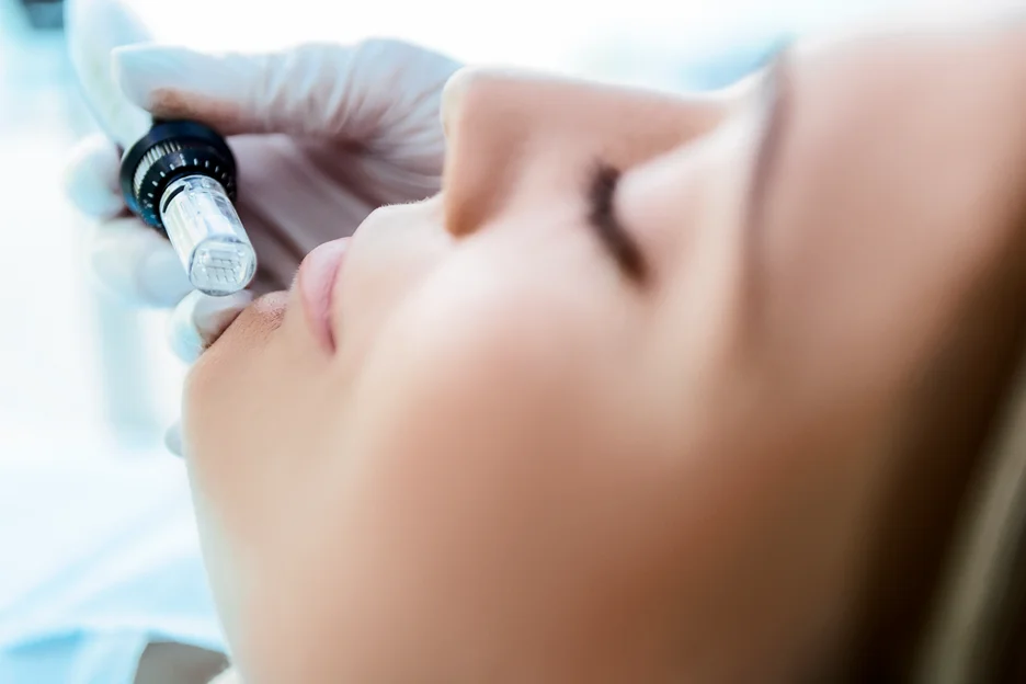 Close-up of a microneedling pen needle cartridge held near a client's face