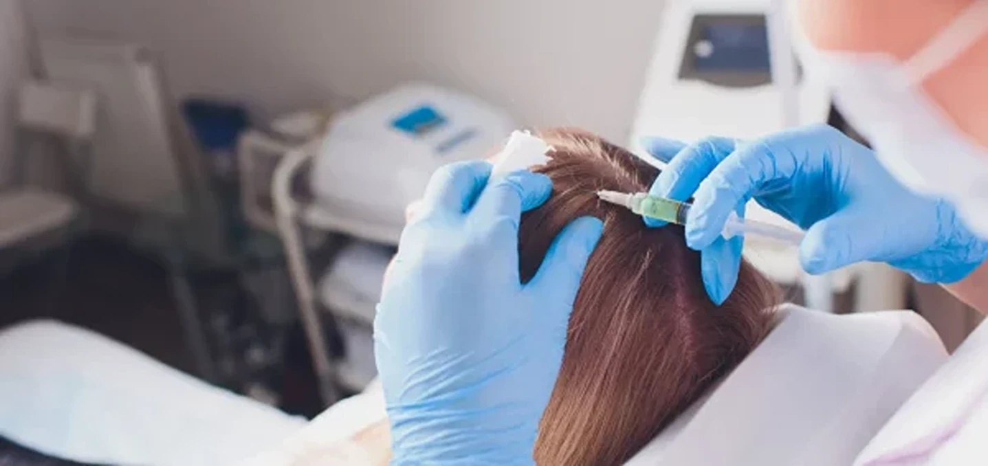 Does PRP for Hair Loss Have Long-Term Effects?