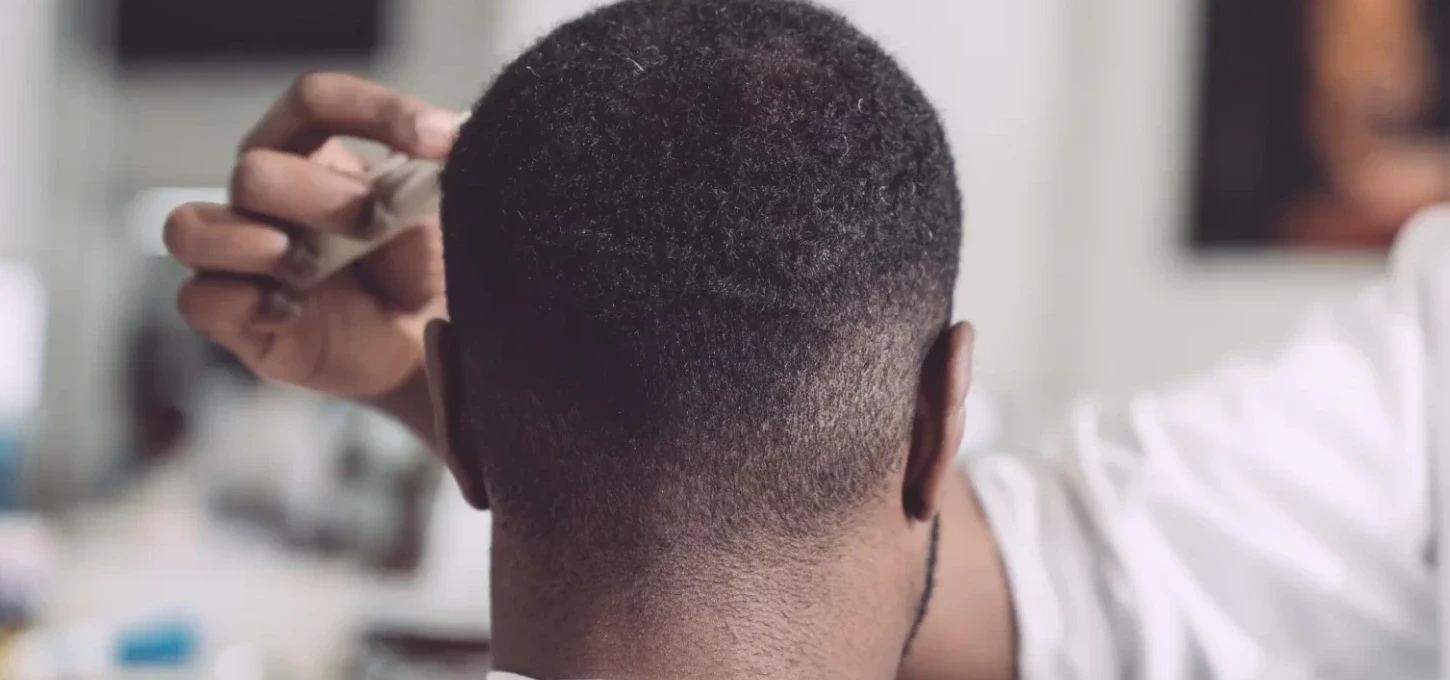 Fibroblast Growth Factors Stimulates Hair Growth