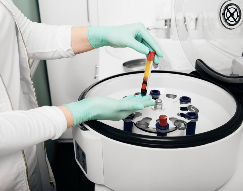 How Do Platelet-Derived Growth Factors Help With Hair Regrowth?