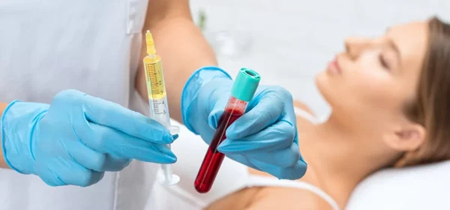 How Many PRP Treatments Would You Need for Hair Loss?