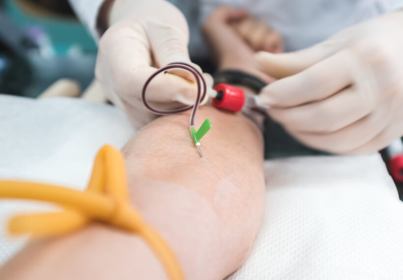 Is Platelet-Rich Plasma Effective in Restoring Your Hair?