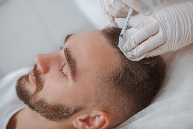 Is PRP and ACell A Good Treatment For Hair Loss?