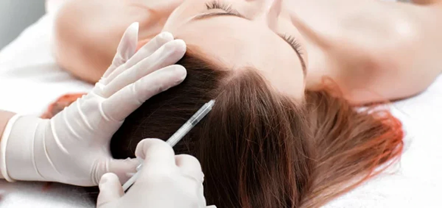 Mesotherapy vs PRP For Hair: Which One Should You Use?
