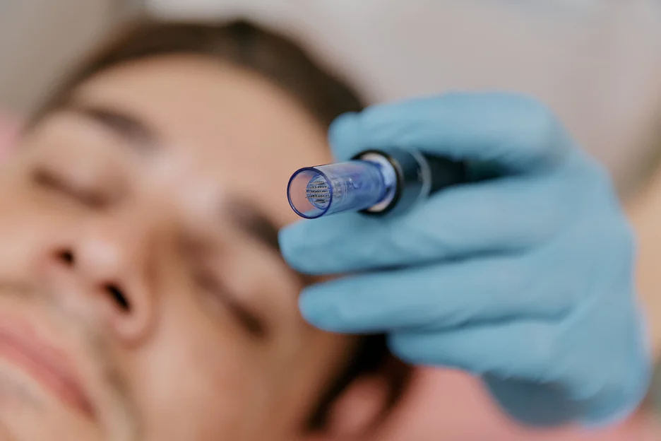 Precision & Efficacy: Mastering Microneedling Pen Techniques for Optimal Patient Outcomes