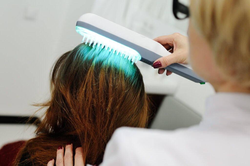What To Expect From PRP Hair Treatment After Hair Transplant