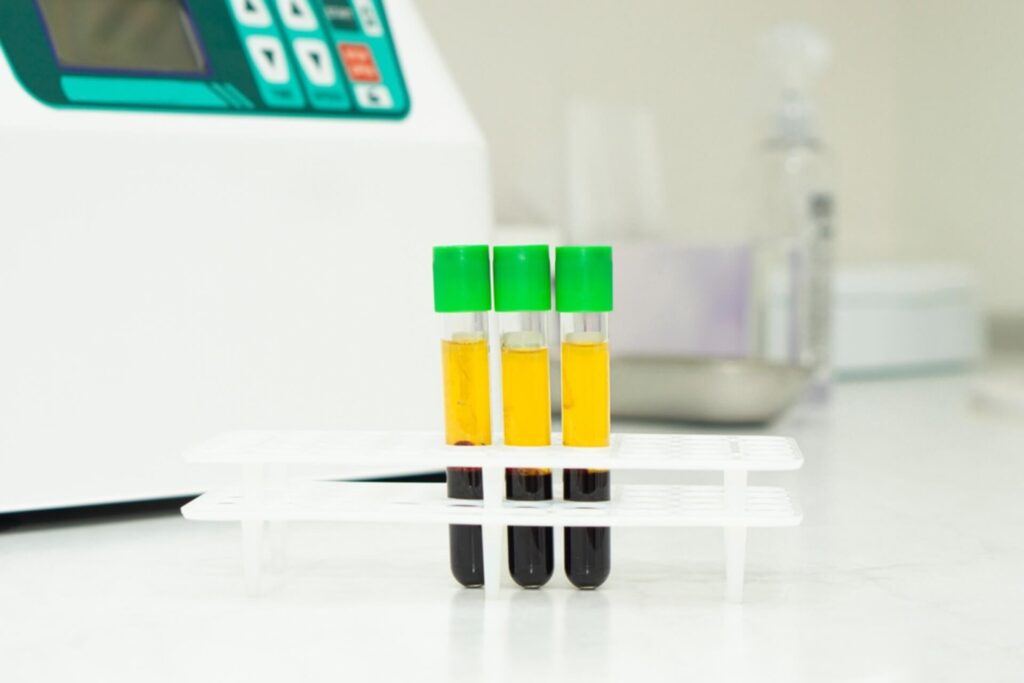 Is There Scientific Research Supporting PRP Treatment And Hair Growth?