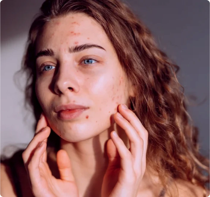Addressing specific skin concerns