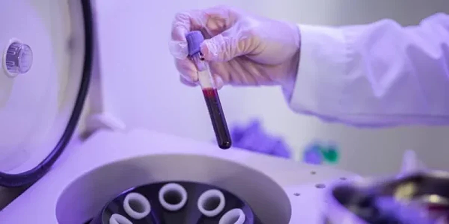 How Do You Use Centrifuge for PRP Preparation