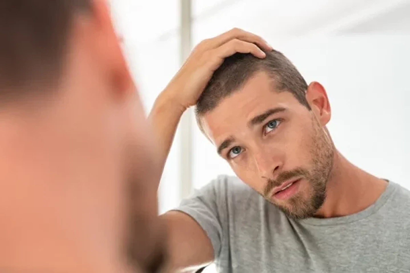 Is PRP Hair Treatment A Permanent Solution To Hair Loss