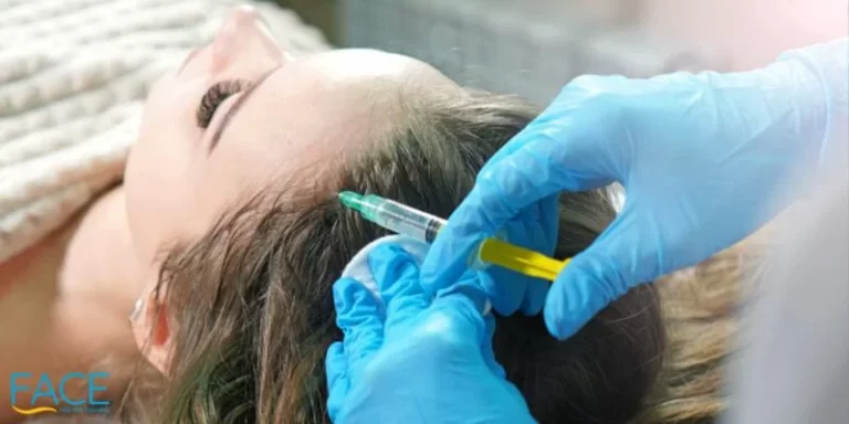 a woman undergoes prp injection procedure in the head
