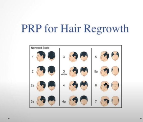 prp2