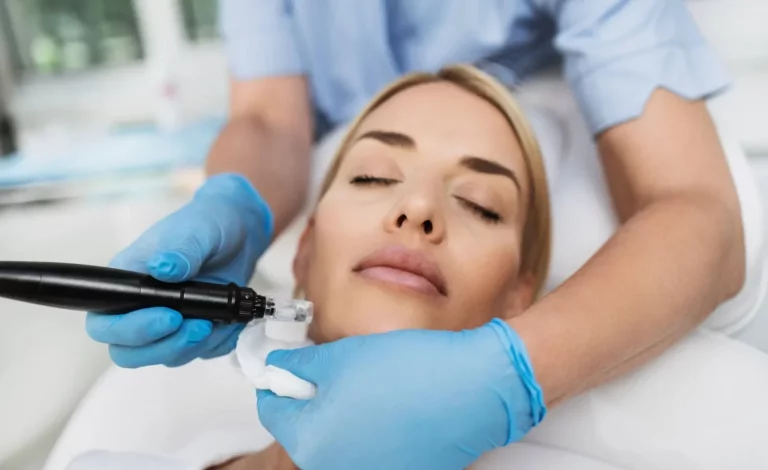 Beautiful blond woman receiving microneedling rejuvenation treatment at beauty clinic