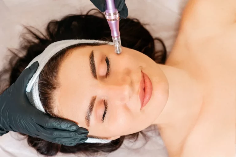 microneedlig treatment on the skin