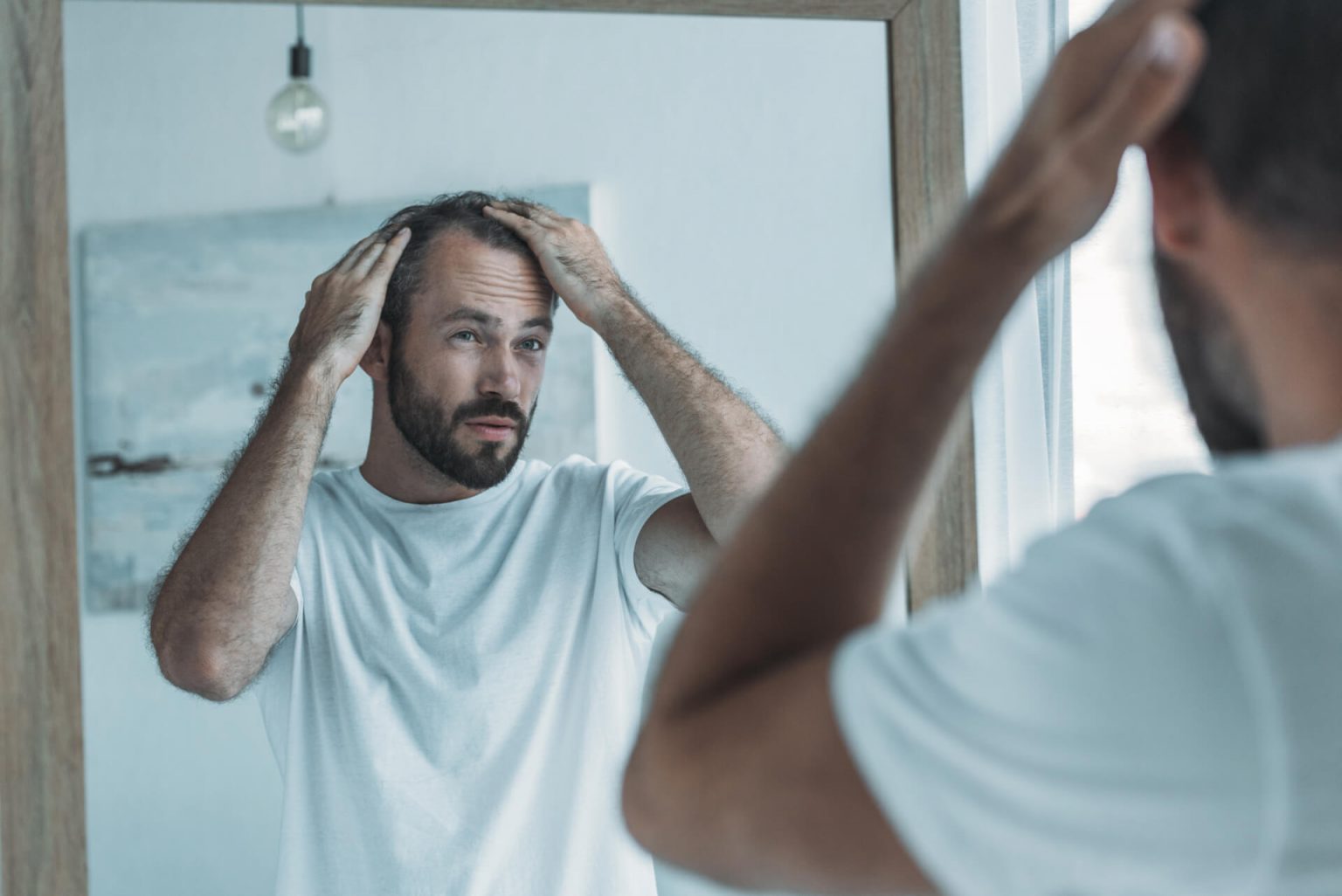 Why Does Testosterone Cause Hair Loss? - Face Med Store