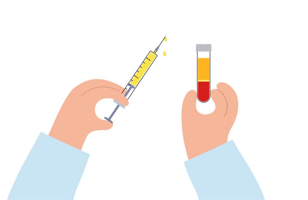 Platelet rich plasma therapy. Blood composition, lymphocytes, thrombocytes and erythrocytes. Sample in laboratory