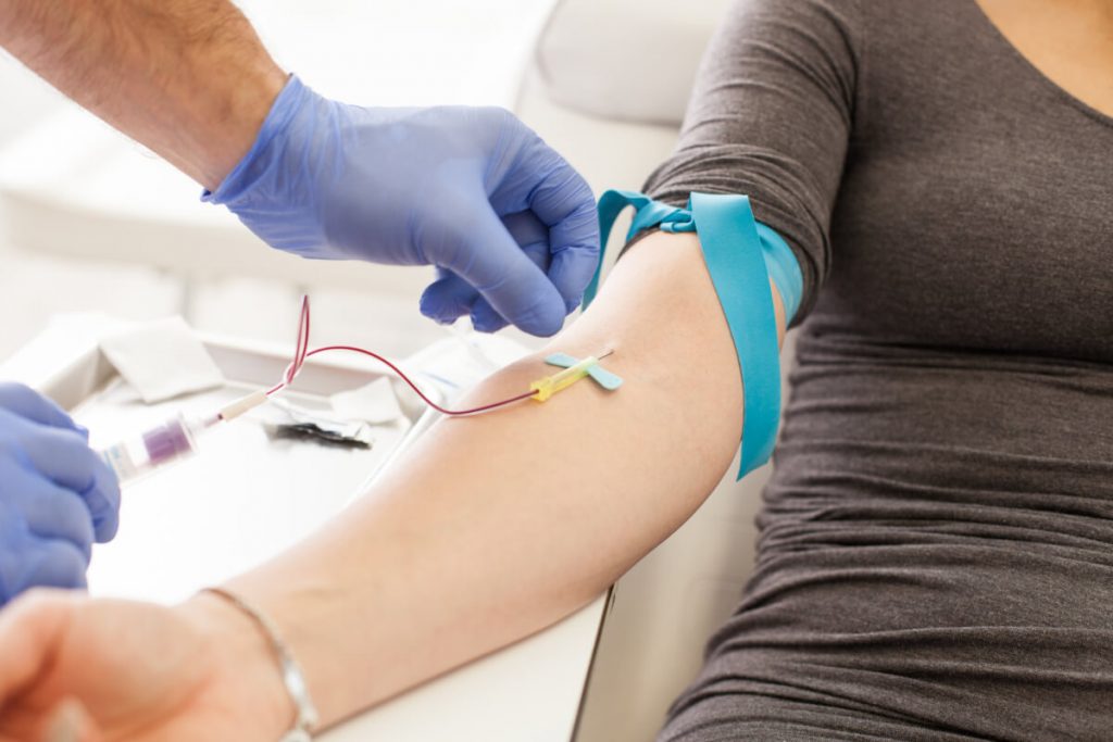 Professional medical office blood drawing through a thin needle, preparing for platelet rich plasma treatment