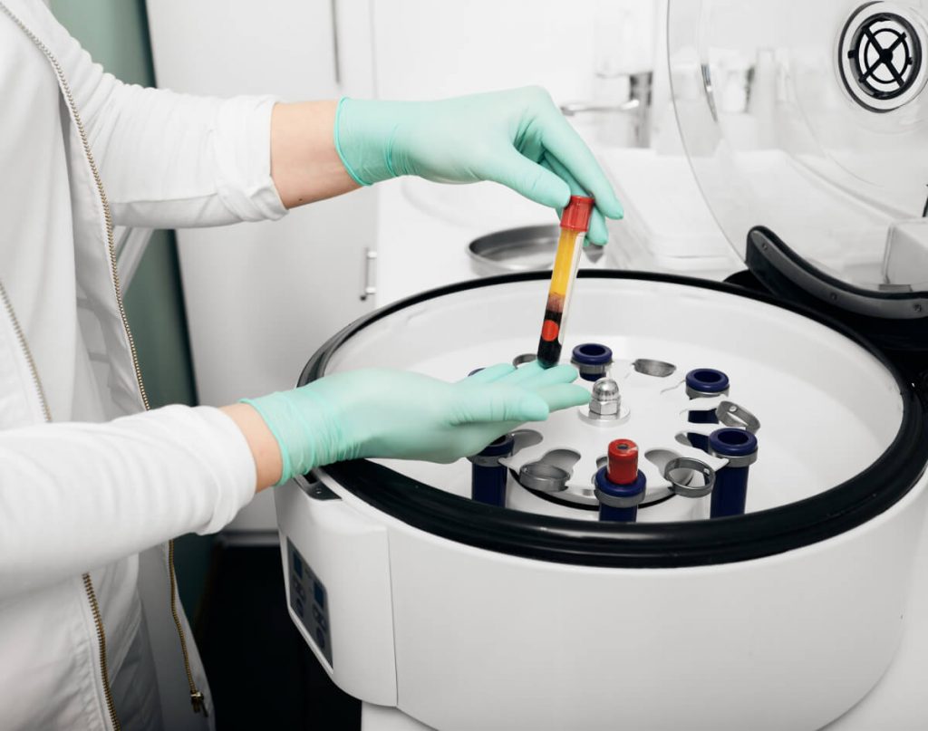 Preparation of blood plasma in a centrifuge for cosmetic procedures for skin rejuvenation