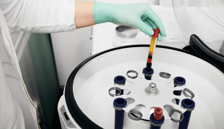Preparation of blood plasma in a centrifuge