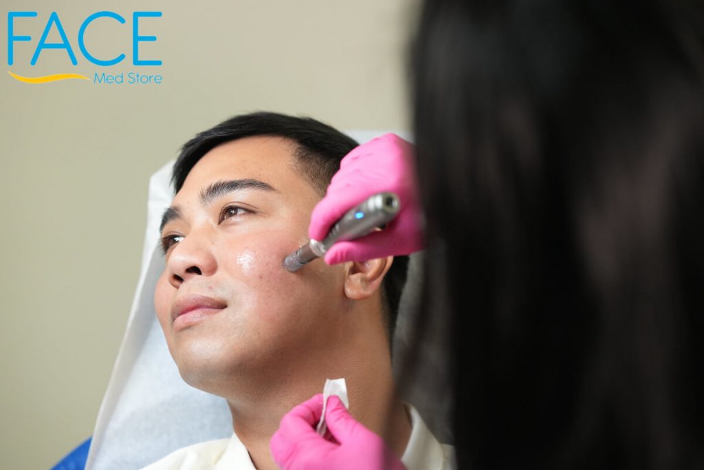 man receiving microneedling with prp