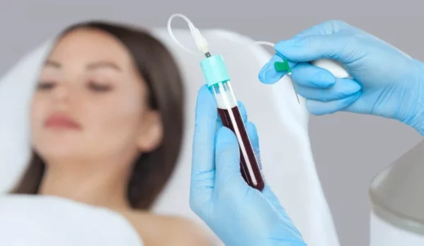 How Much Blood Do You Need for One PRP Treatment for Hair