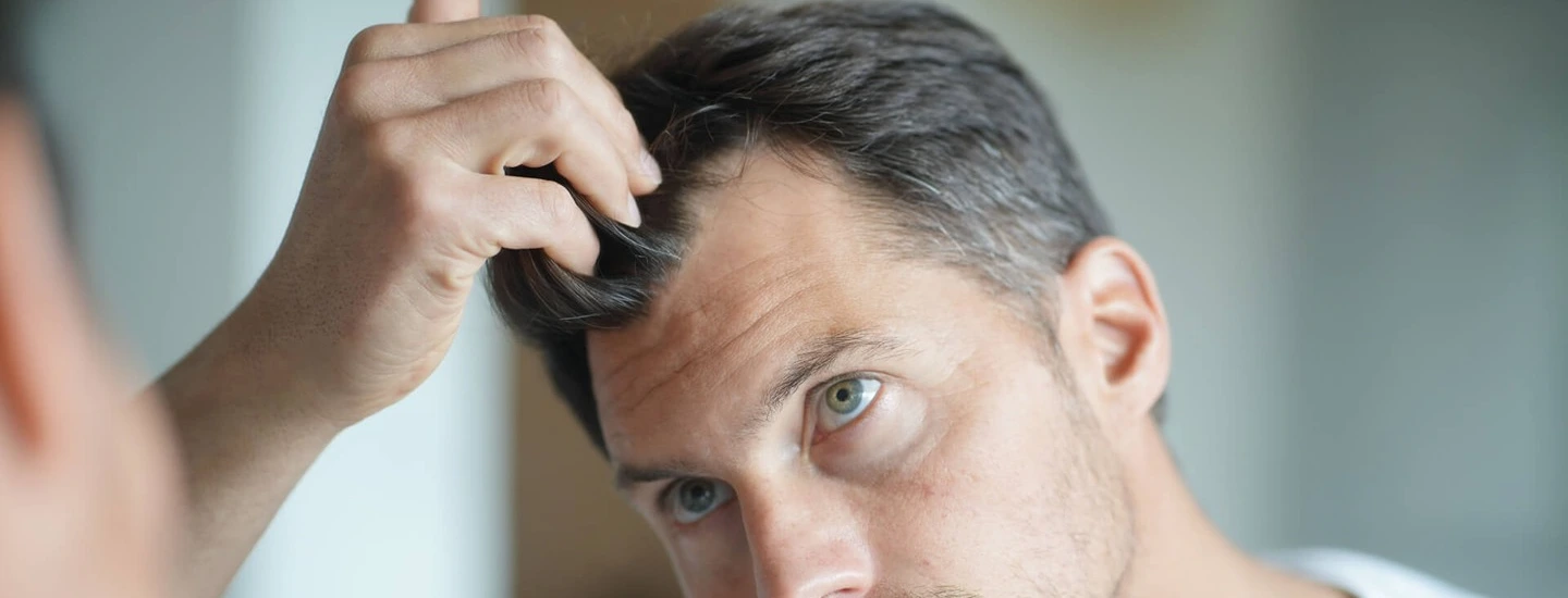 Vitamin D Deficiency HAIR LOSS | Is Vitamin D Hair Loss Reversible? -  YouTube