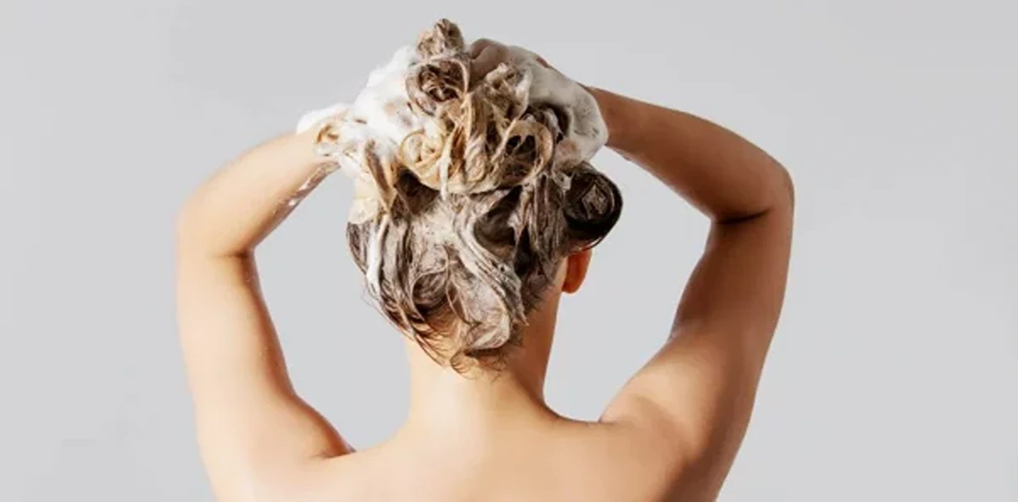 Should You Wash Your Hair to Prepare PRP for Hair Loss