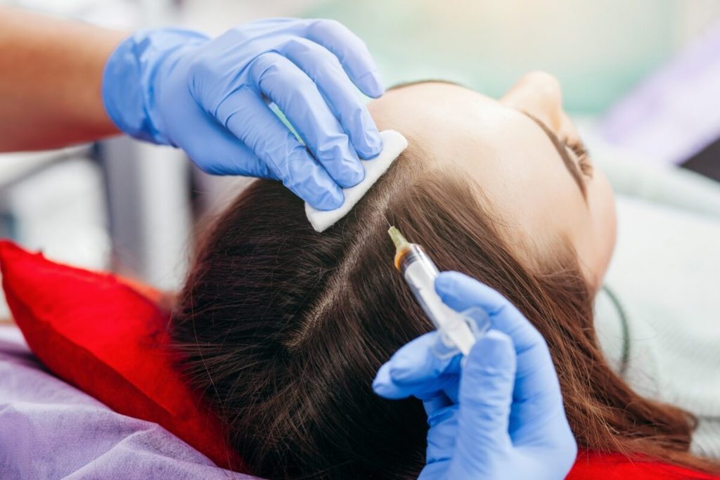 Young woman with hair loss problem receiving prp injection