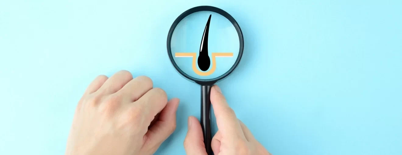 checking hair condition by doctor images magnifying glass and hair illustration