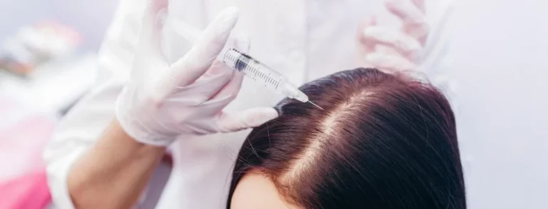 young woman with hair loss problem receiving PRP