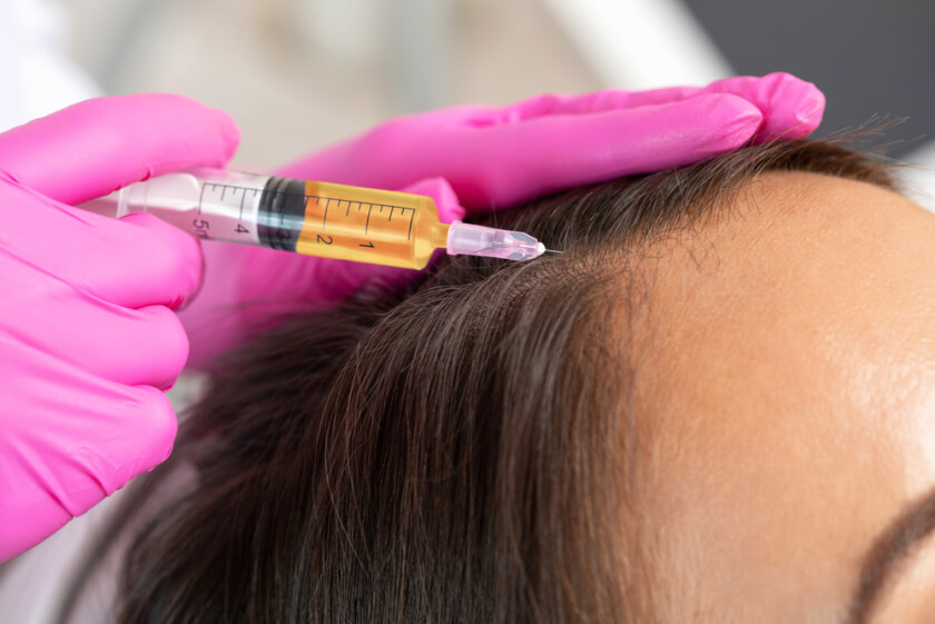 Cosmetologist does prp therapy against hair loss