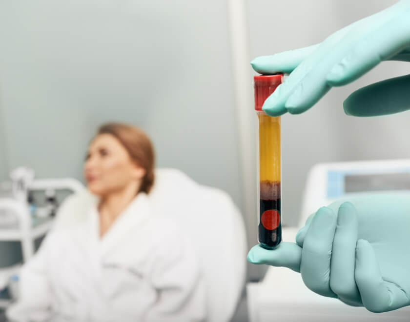 Test tube with blood plasma