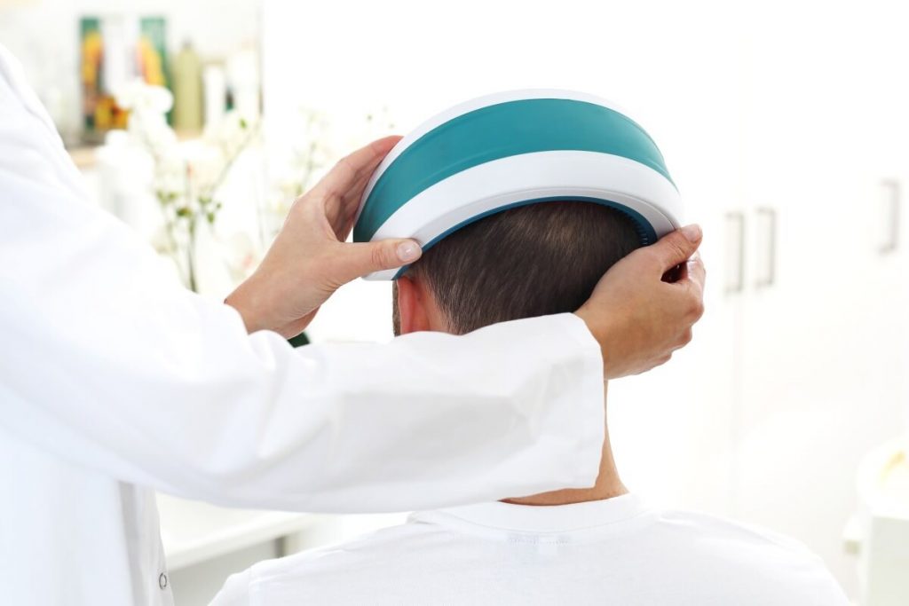 Treatment against hair loss