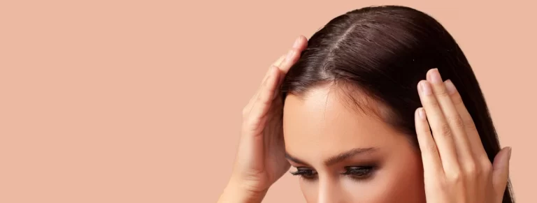 Woman serious hair loss problem