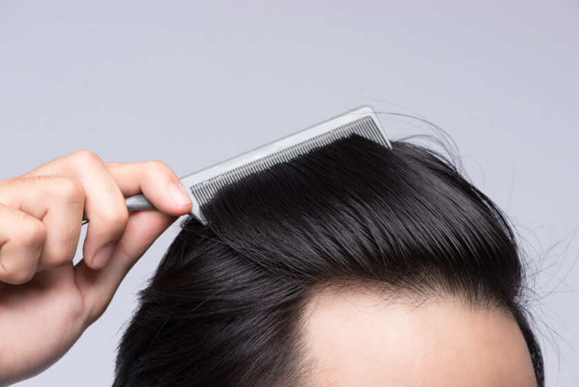 Young man comb his hair after prp treatment