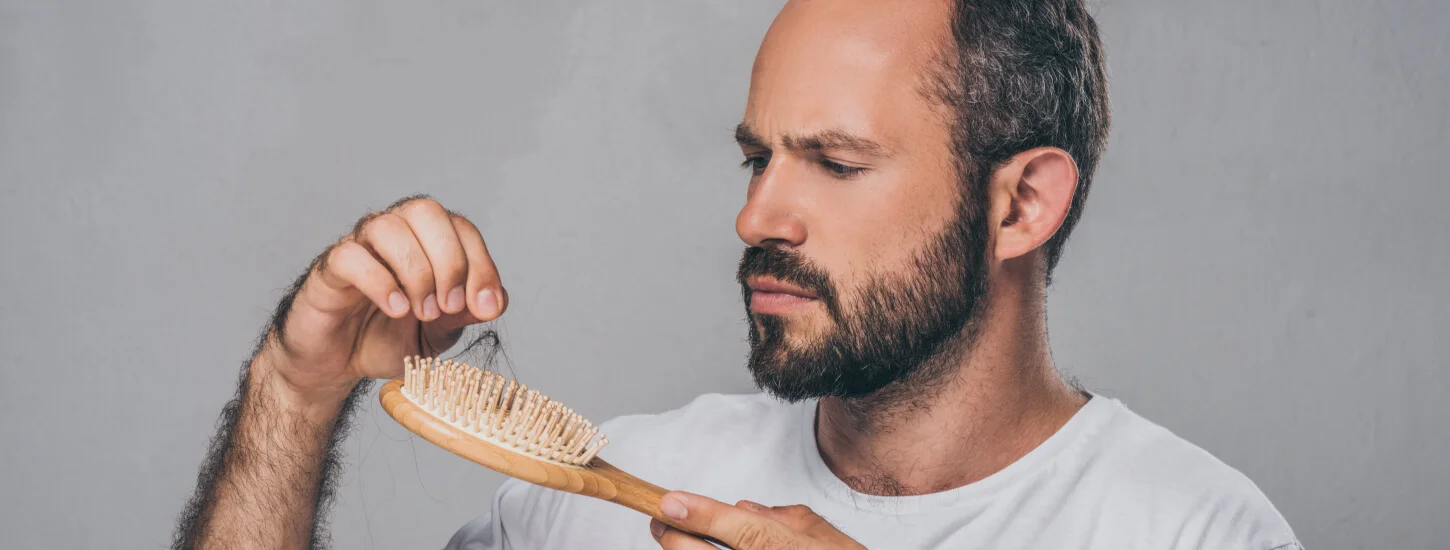bearded middle aged man holding hairbrush suffering hair loss