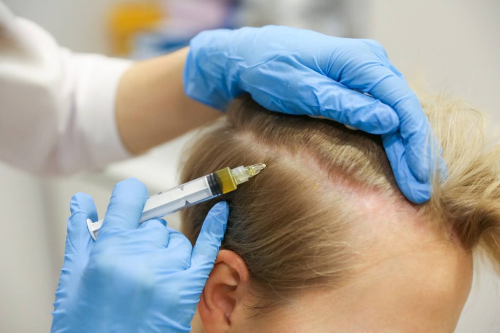 prp treatment for hair growth