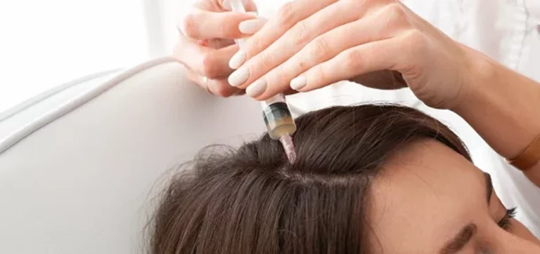 Platelet-Rich Plasma Injections for Hair Pre- and Post-Care