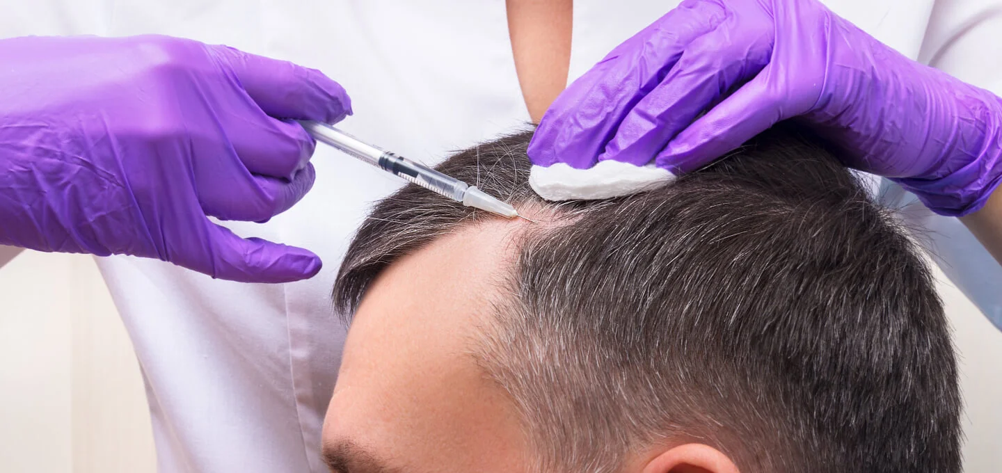 man getting prp for hair loss
