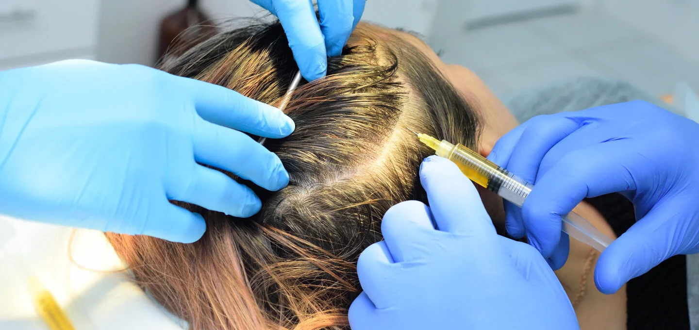 woman getting prp treatment for hair