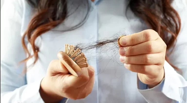 Exosomes vs PRP for Hair Loss Which is Better