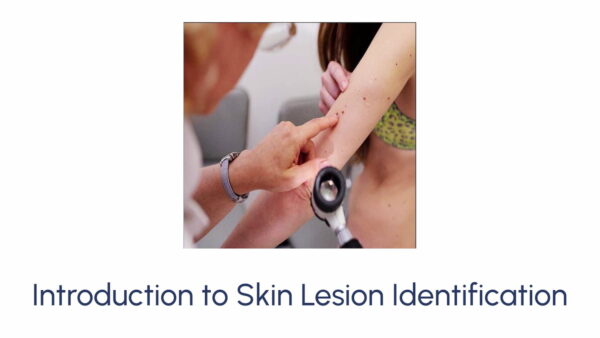 Introduction to Skin Lesion Identification Course Img