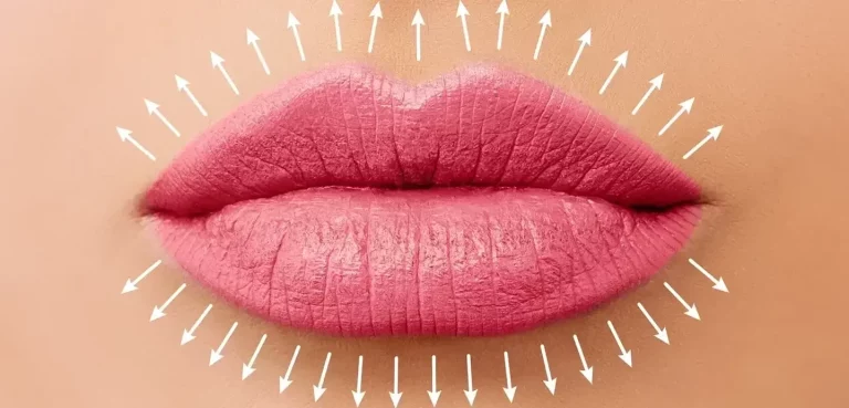 Beautiful perfect pink lips from lip filler