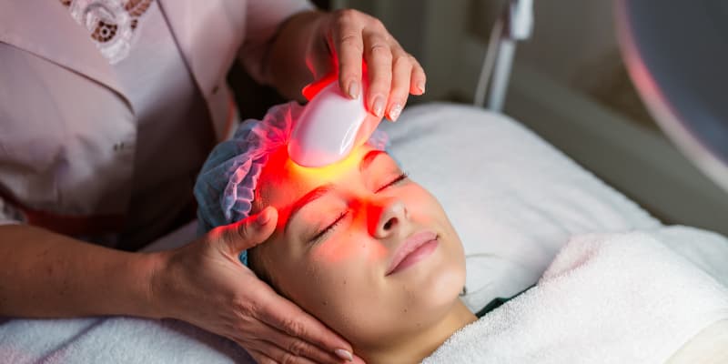 Intense Pulsed Light (IPL)