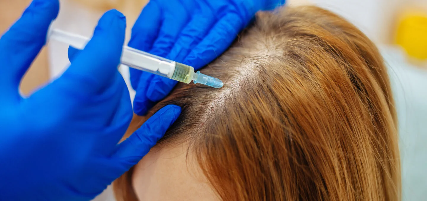 PRP Therapy vs. PRP With Stem Cell: Which is Better for Your Hair? – Face  Med Store
