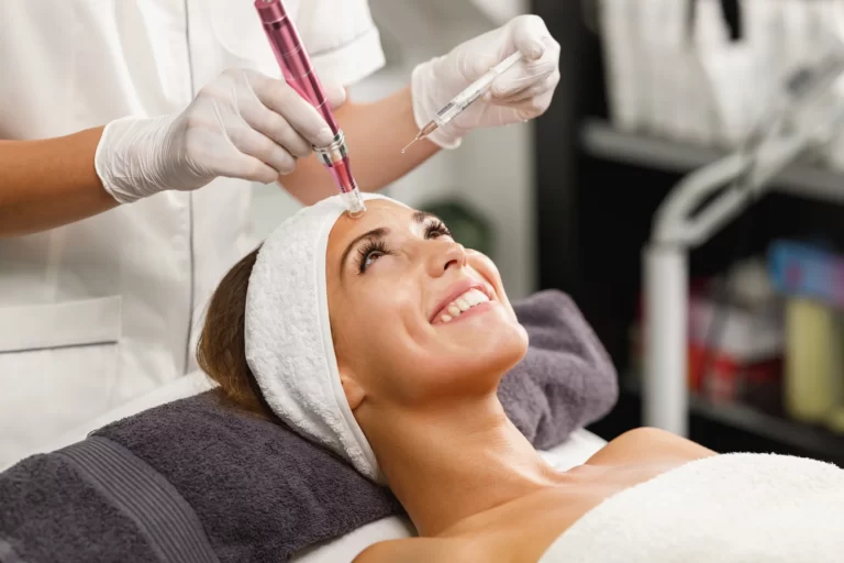 a woman received dermapen microneedling procedure in a beauty clinic