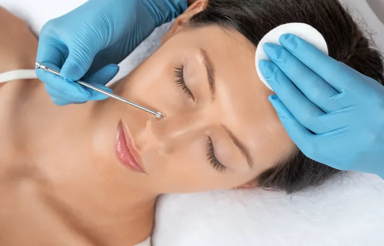 esthetician performs extraction procedure