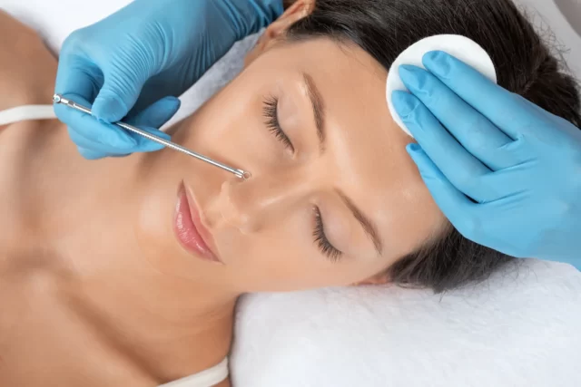 esthetician performs extraction procedure