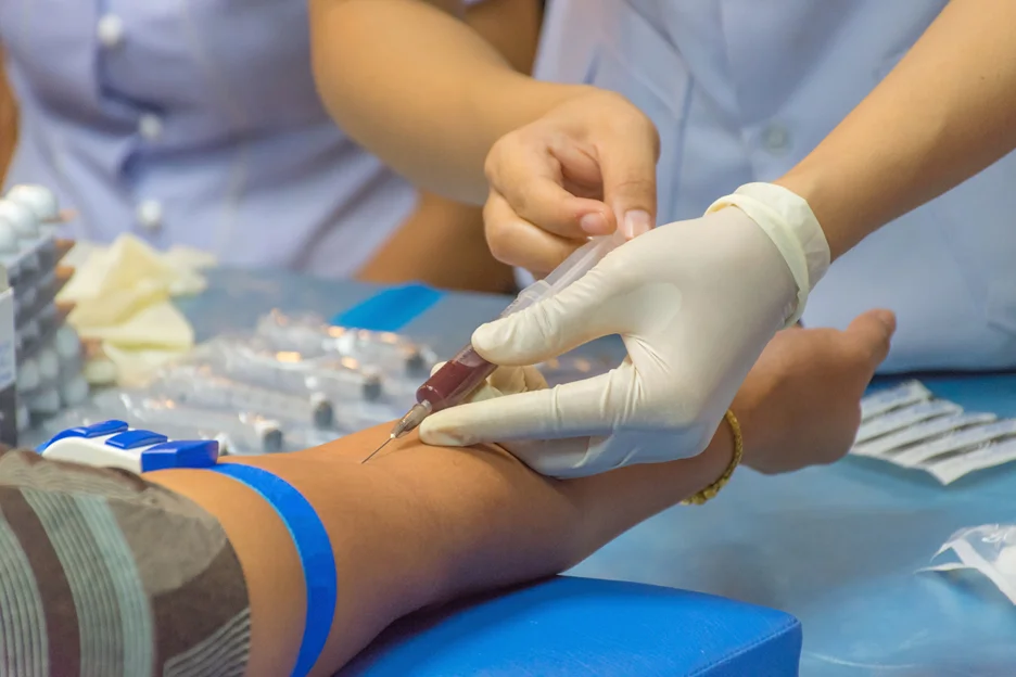 blood drawing using straight needle