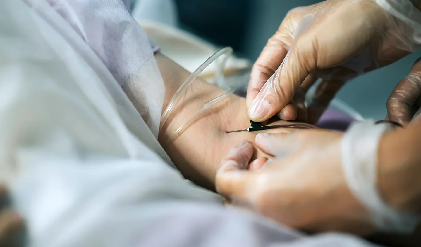 a nurse inserts butterfly needle on the patient's arm